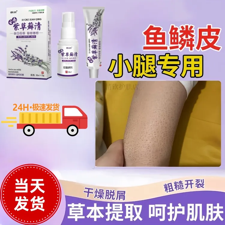 鱼鳞皮肤霜膏专用去除神器蛇皮身体乳鸡皮肤疙瘩毛囊角化起皮脱屑