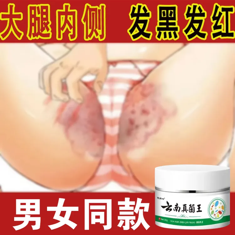 男女通用大腿内侧好痒越抓越痒潮湿红肿异味瘙痒外用止痒抑菌软膏
