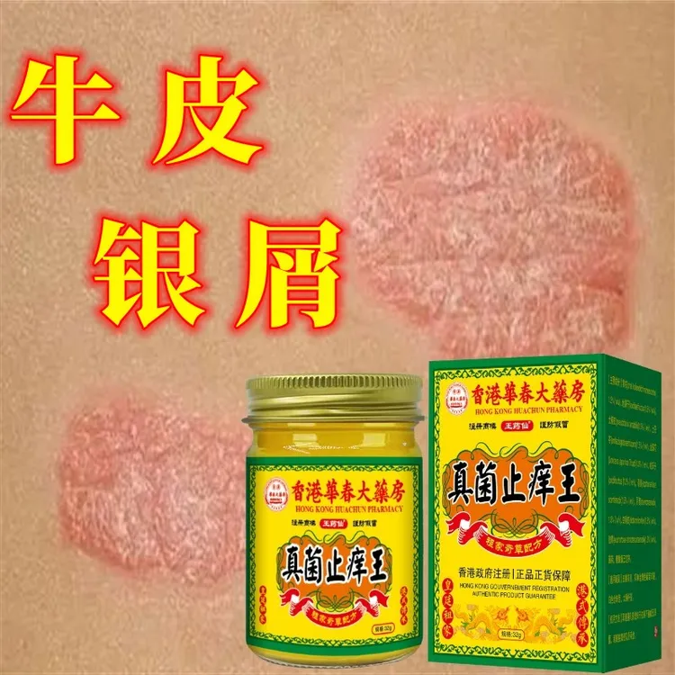 【真菌王】全身牛/皮/银/屑/手足头体股大腿内侧止痒软膏药专用肤癣