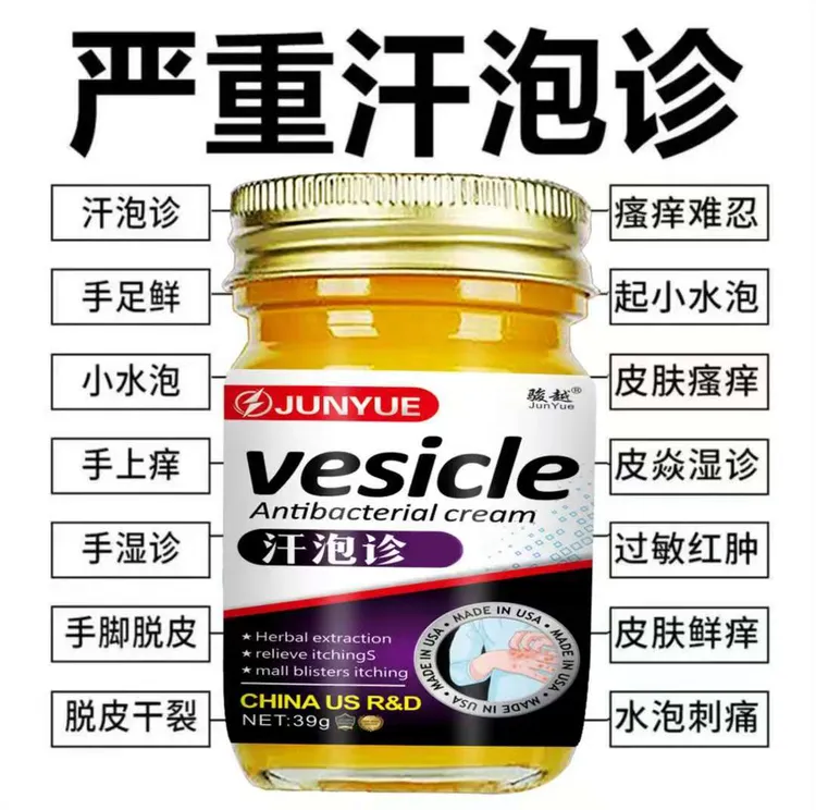 汗泡诊手上起小水泡止痒膏脱皮抑菌手指缝痒干裂草本萃取涂抹乳膏