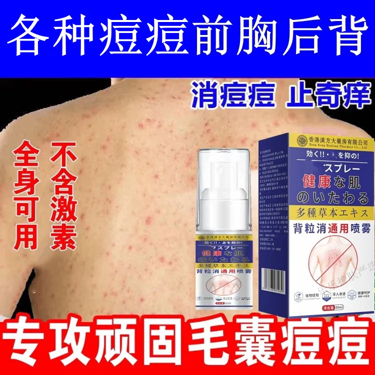 后背毛囊痘祛痘喷雾剂男女去止痒背部胸前身体香体背上祛痘痘神器