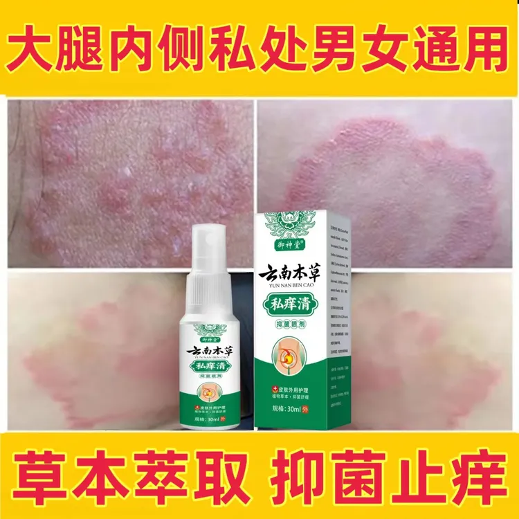 大腿内侧瘙痒越抓越痒大腿和睾丸夹缝处潮湿异味外用止痒抑菌喷剂