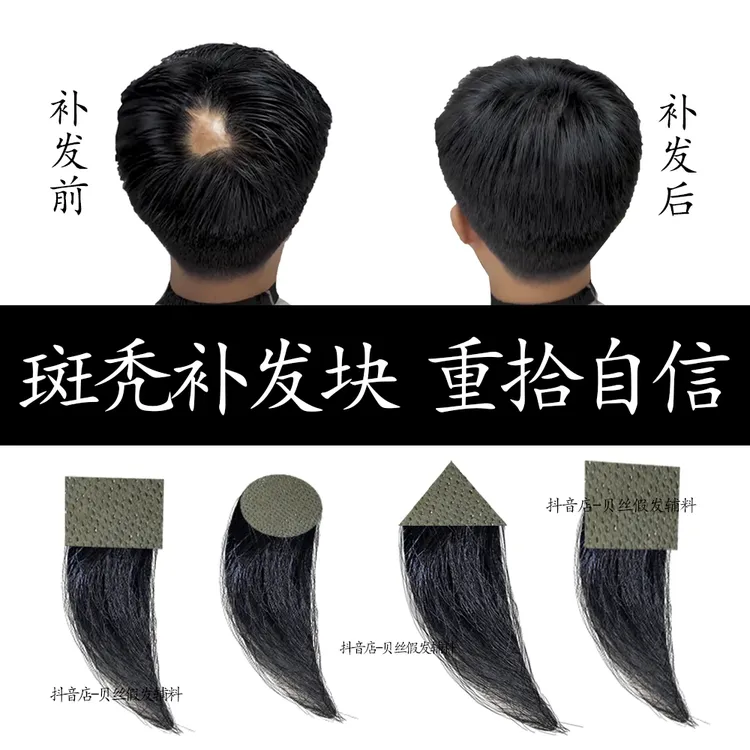 头部疤痕补发斑秃补发片伤疤局部补发头皮小面积补发神器补发片