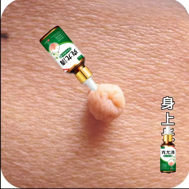 身上长肉求凸起疙瘩肉粒皮赘脖子腋下小肉求寻常疙瘩护理温和液