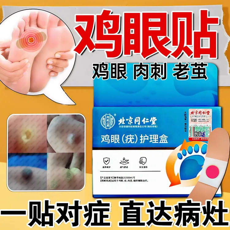 北京同仁堂鸡眼贴鸡眼怎么去鸡眼怎么祛去肉粒疙瘩专用鸡眼膏鸡脚眼贴脚上跖疣去手上脚趾脚眼贴肉茧疣瘊鸡眼（疣）护理盒内廷上用