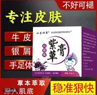 【紫草膏】全身牛/皮/银/屑/手足头体股大腿内侧止痒软膏专用肤癣
