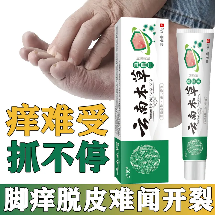 云南真菌王手足霜脚后跟开裂防裂膏足部抑菌喷雾手足脱皮抑菌膏