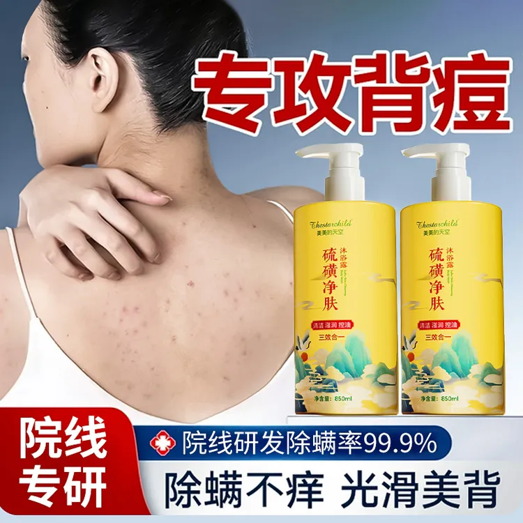 【旗舰正品】硫磺除螨沐浴露水润嫩肤温和控油净螨去背痘止痒去鸡皮