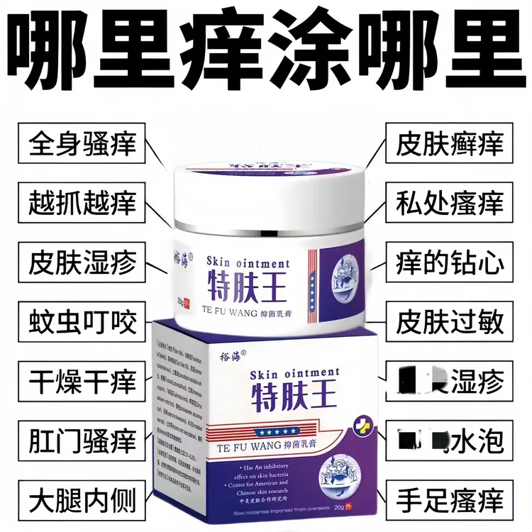 全身止痒特肤王手上身上后背大腿内侧各种瘙痒纯植物草本抑菌乳膏