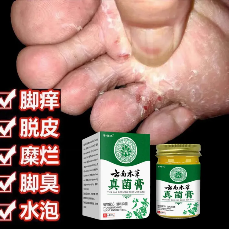 【脚汽专用】脚趾缝痒脱皮脚出汗脚痒干裂脚臭起水萢脚痒止痒乳膏