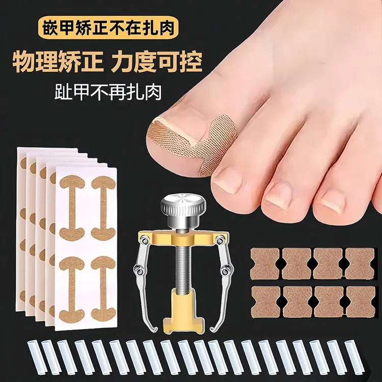 甲沟矫正器嵌甲贴片炎脚趾甲往肉里长脚指甲专用隔离垫片正甲神器
