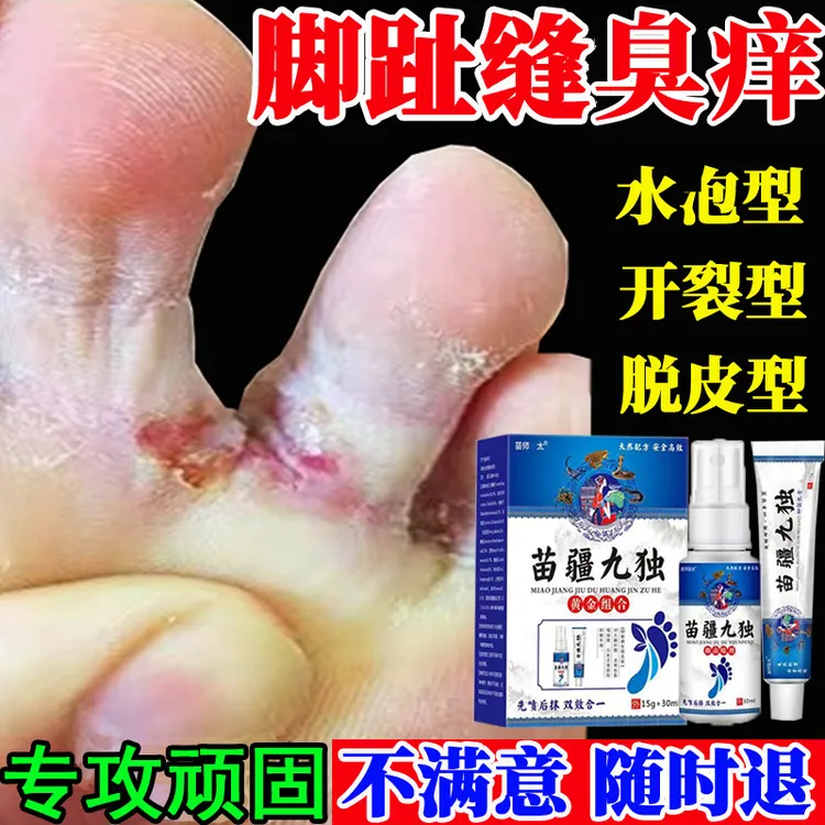 脚趾缝臭痒专用脚痒脚水泡脱皮真菌王脚抑菌神器开裂克星喷雾剂