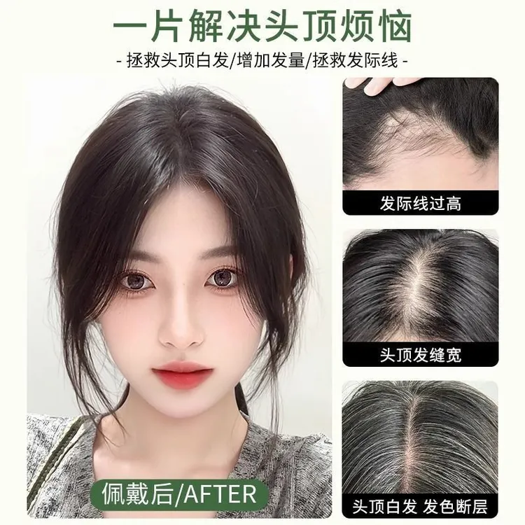 全真人发丝颅顶增高 头顶真人发补发假发片蓬松增发量遮白发假发