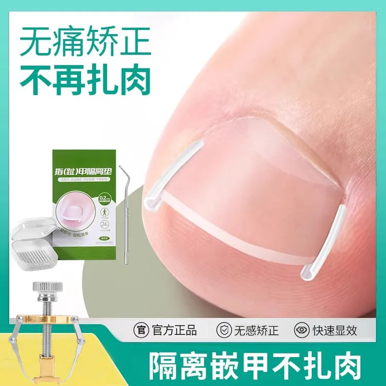 甲沟炎矫正神器脚趾甲长肉里怎么办嵌甲专用指甲矫正器隔离填充垫