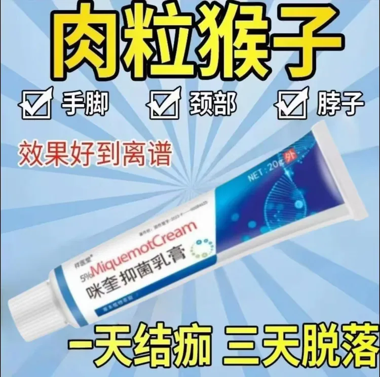 【急速发货】%5咪喹莫特正品乳膏 20/g支小肉 粒球专用