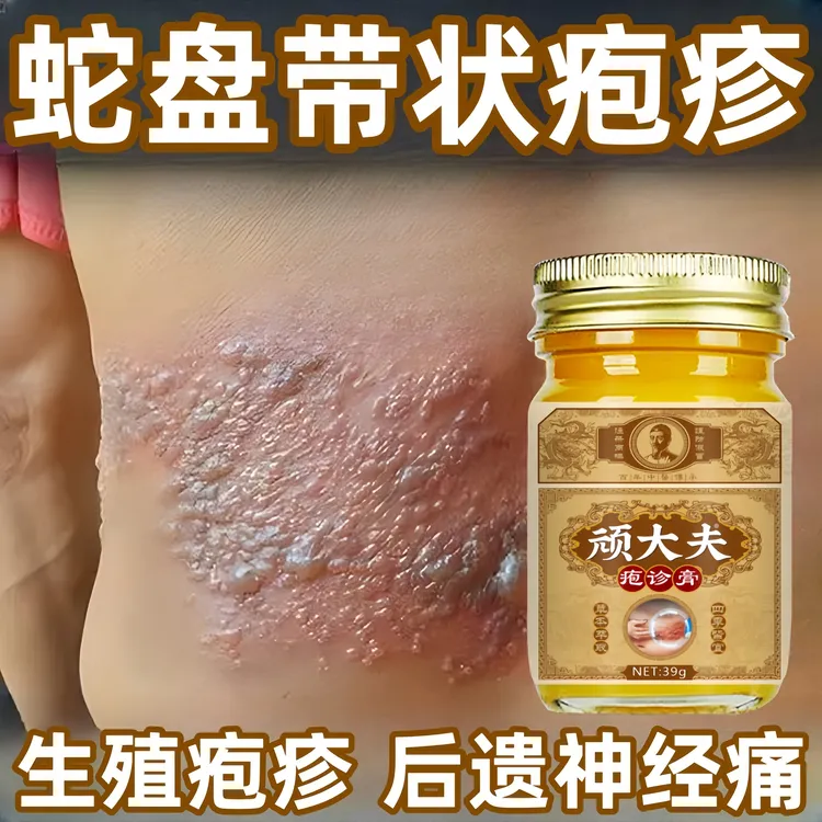 带状泡疹后遗症神经痛蛇盘疮膏蛇盘清宝缠腰龙生直器疱专用特效膏
