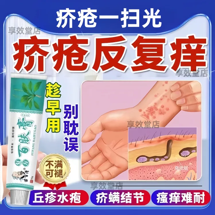 疥痒灵止痒特效疥螨虫一扫光快速搔痒疥痒专用顽痒王学生常备