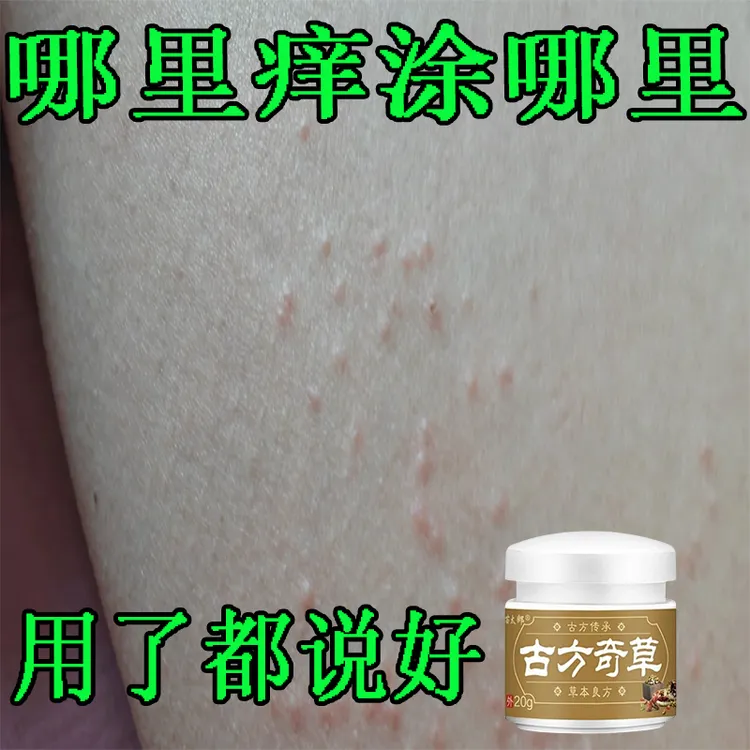 古方奇草草本全身止痒膏皮肤膏温和涂抹亲肤正品