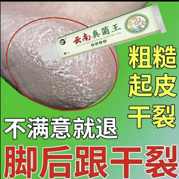 云南真菌王脚起皮脚脱皮修复膏脚后跟开裂皲裂防裂止痒膏