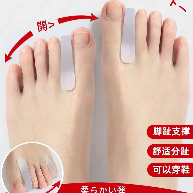脚趾矫正神器拇外翻纠正大脚骨头突出防磨分趾器脚指重叠分离器