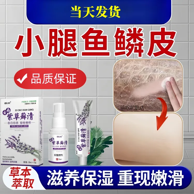 鱼鳞皮肤霜膏专用去除神器毛囊角化起皮脱屑蛇皮鸡皮肤疙瘩