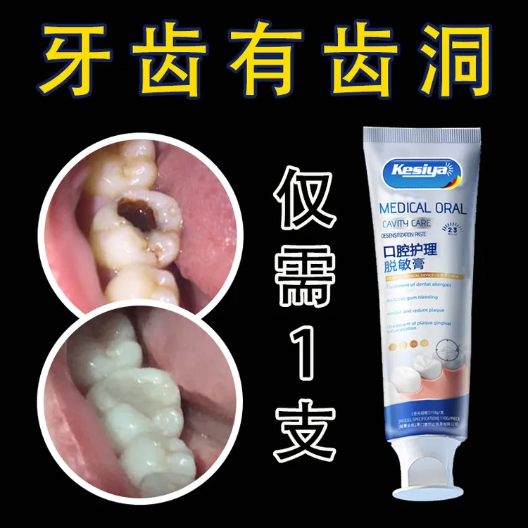 【牙膏界的佼佼者】德国牙膏牙黄牙黑敏感大牌护理牙膏KSY5