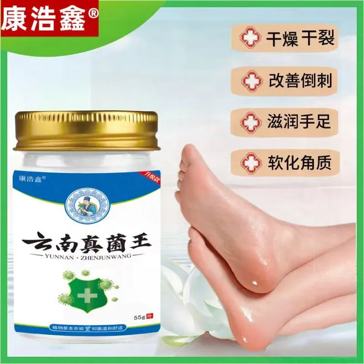 【康浩鑫正品】云南真菌王植物萃取皮肤手脚干燥开裂脚臭脚痒脱皮膏