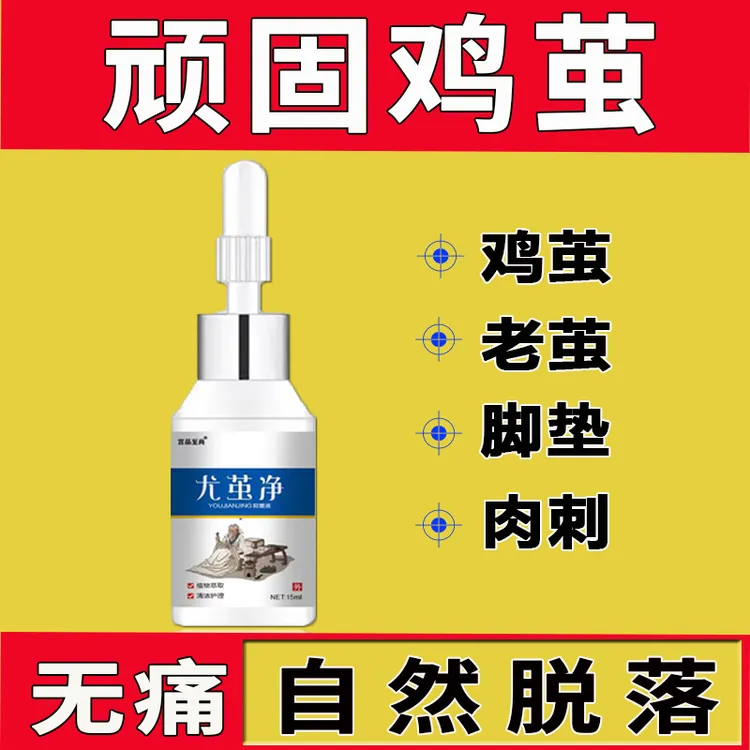 宫品至尚尤茧净去鸡茧老茧膏软化剂肉刺脚钉厚茧草本萃取足部护理