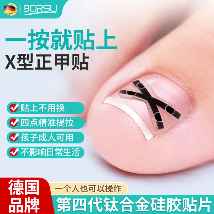 德国BORSU正甲贴片X形钛合金指甲贴片