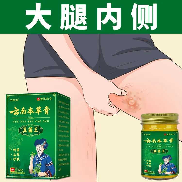 男女通用大腿内侧止痒膏植物草本萃取温和外用涂抹护理云南真菌王