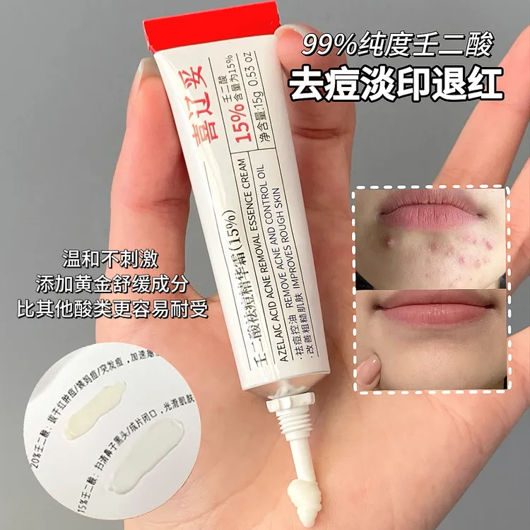 痘痘橡皮擦！喜辽妥壬二酸祛痘精华霜淡化痘印补水保湿修复改善