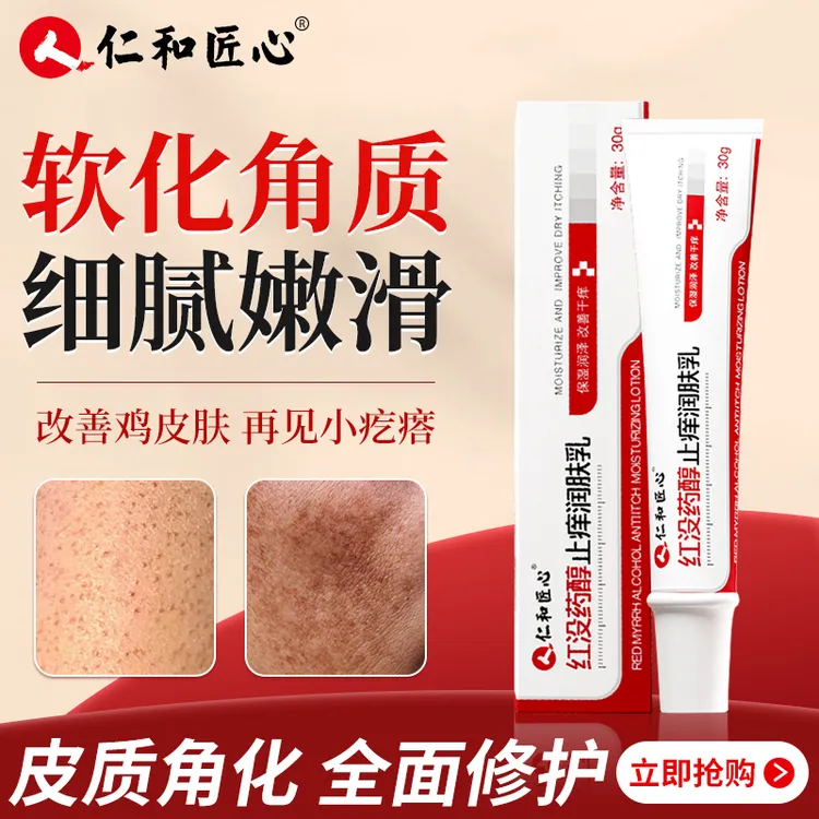 毛周I角I化鸡皮肤小疙瘩脸上手臂腿上粗糙修复改善身体乳尿素霜