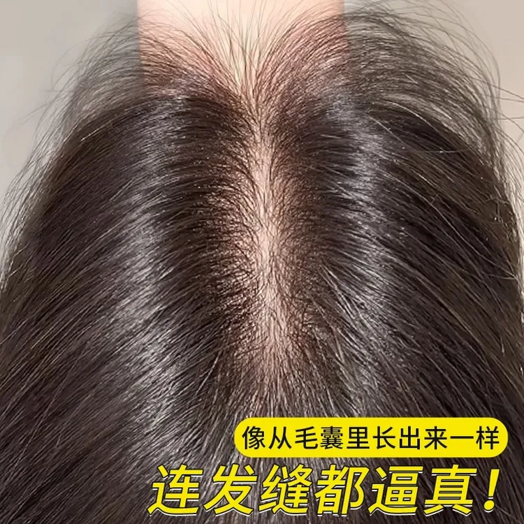 【为夏而生】双递针补发片女头顶遮白发增发蓬松高颅顶轻薄自然无痕