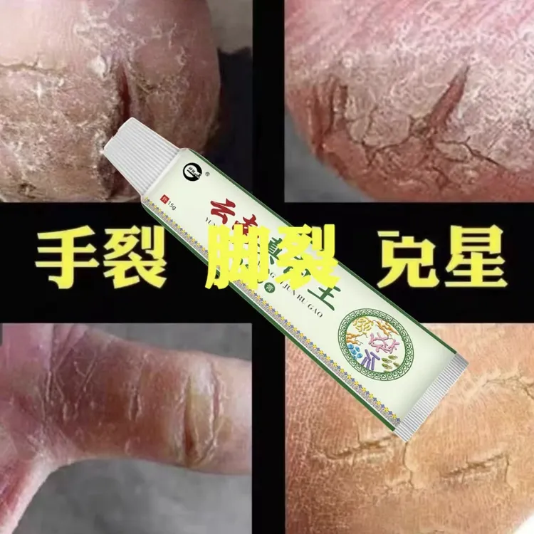 云南真菌王脚起皮脚脱皮修复膏脚后跟开裂皲裂防裂止痒膏