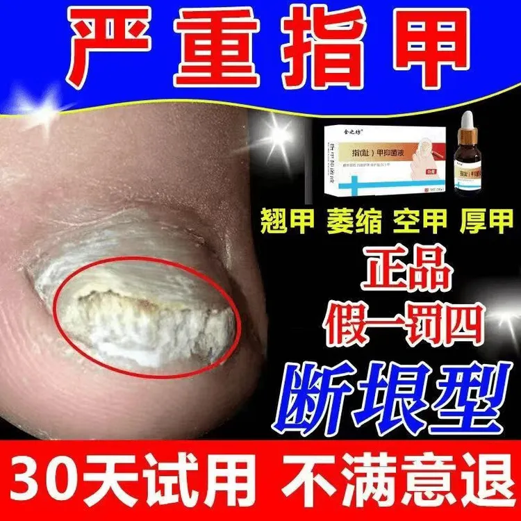 手指趾甲专用液亮甲正品抑菌液发灰发黄增厚脚指甲根特正效治品快