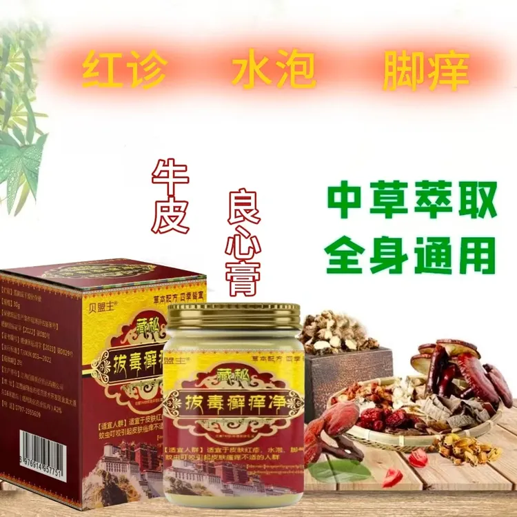 【藏秘很牛的拔毒膏】抑菌止痒膏舒缓水泡红点痒草本抑菌涂抹外乳膏