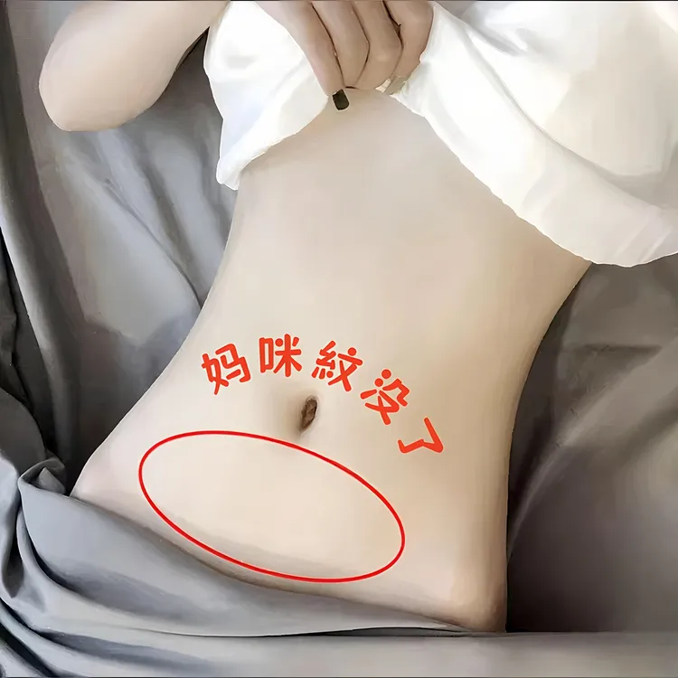 妈咪默默无紋 修护膏 抚紋霜精华 紧致修护 养护妈咪 产后无紋