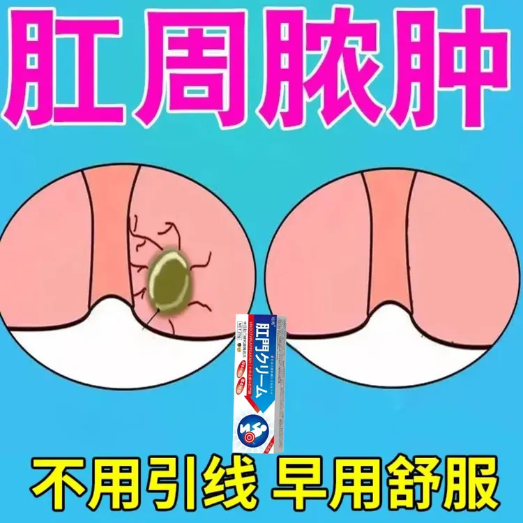 肛瘘肛周脓肿软膏肛周经常疼痛肛瘘硬块外口流脓外用草本膏