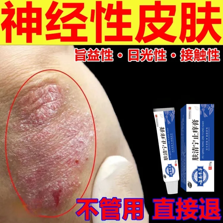 肤清宁瘙痒止痒膏神经性皮肤湿痒手脚水泡小腿全身可用抑菌专用