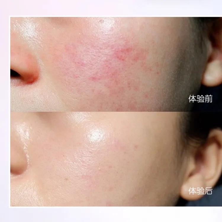 水澜之迷舒悦沁亮精华霜