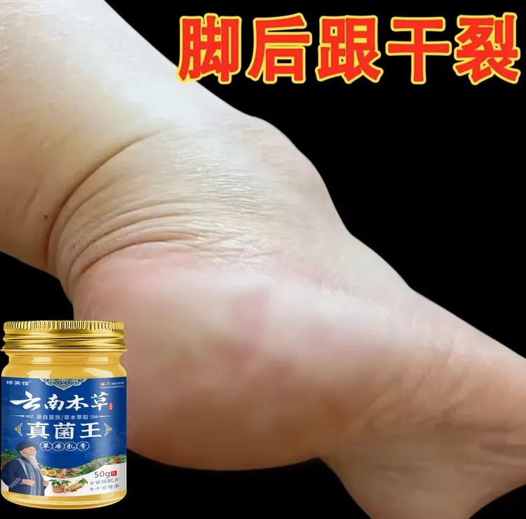 正品云南真菌王脚后跟开裂专用防裂膏手足干裂修复膏保湿粗糙嫩滑