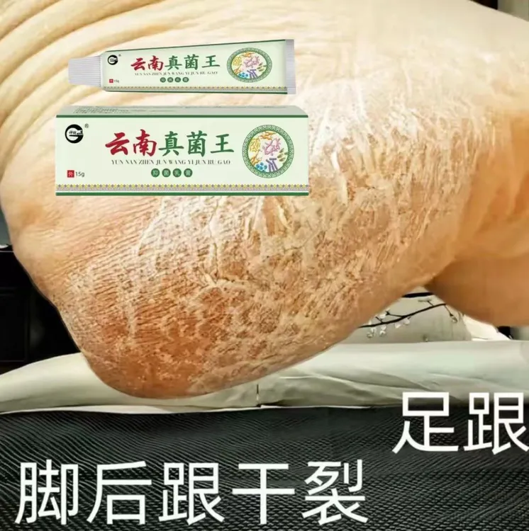 脚后跟开裂起皮脚脱皮修复膏脚后跟开裂皲裂防裂膏脚裂软膏舒缓