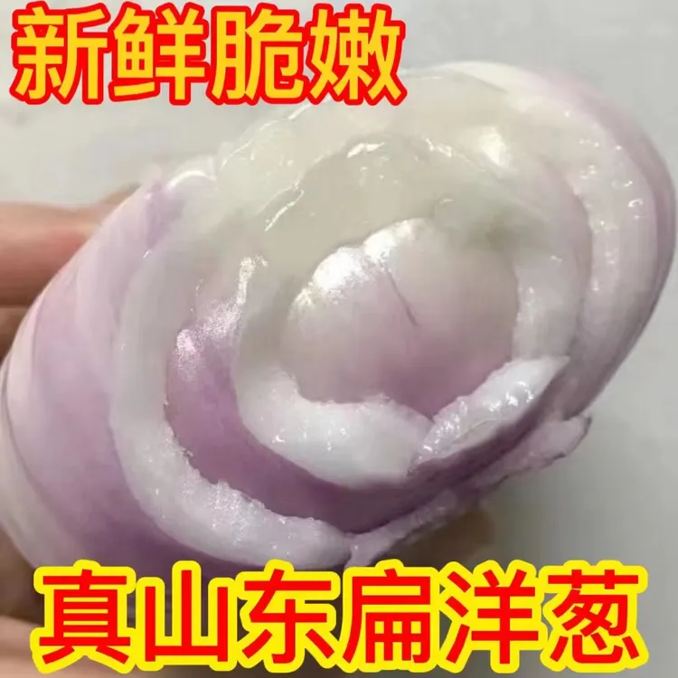山东水果新鲜现挖水果扁洋葱微辣微甜可以生吃洋葱农家自种5斤 装