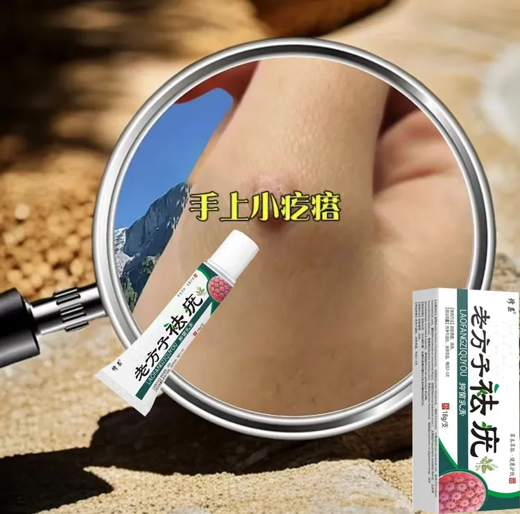 【小肉粒专用】老方子克尤膏脖子手足腋下丝状扁平肉刺