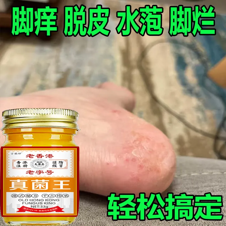 正品真菌王脚痒脚臭脚缝痒脱皮香港脚脚底痒外用抑菌止痒