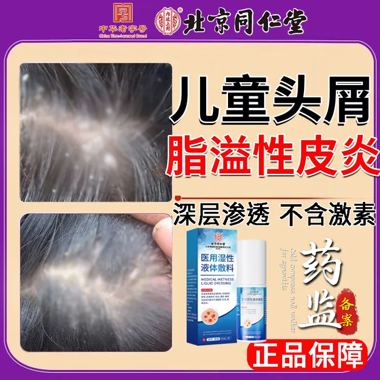 北京同仁堂头皮脂溢性皮炎专用喷雾剂毛囊炎改善头屑头痒皮炎痤疮湿疹及多种皮肤问题儿童成人通用内廷上用医用湿性液体敷料