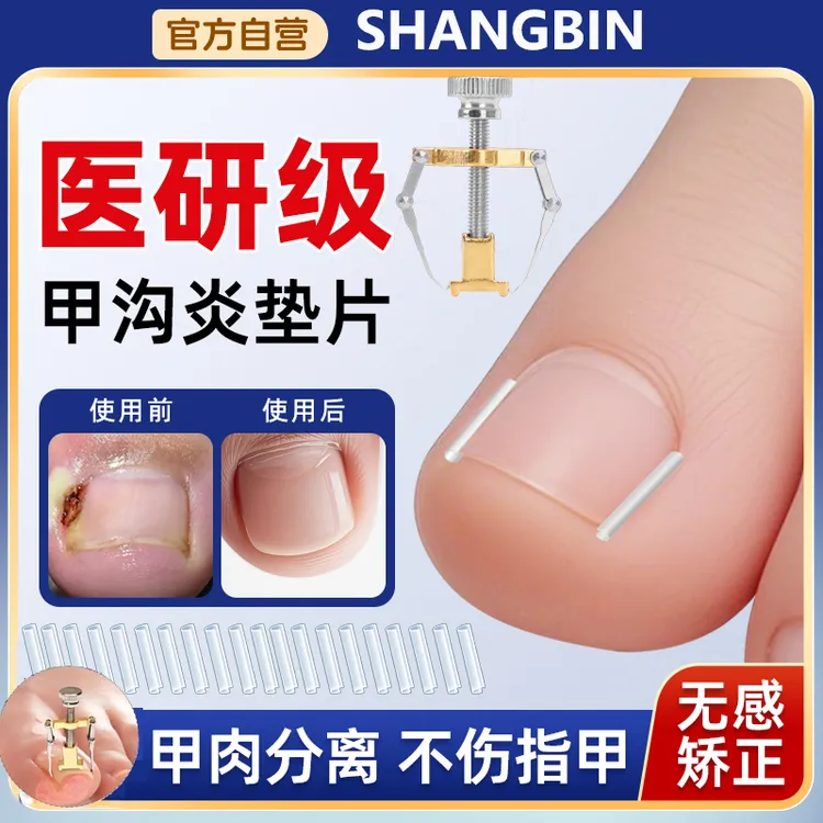 甲沟炎矫正神器嵌甲指甲矫正器脚指甲往肉里长怎么办专用填充垫片