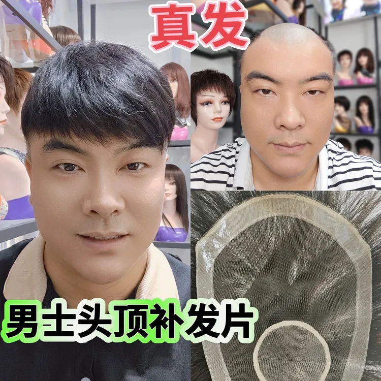 男士假发头顶补发片男士发片轻薄透气新款夏季专用递针全手织假发