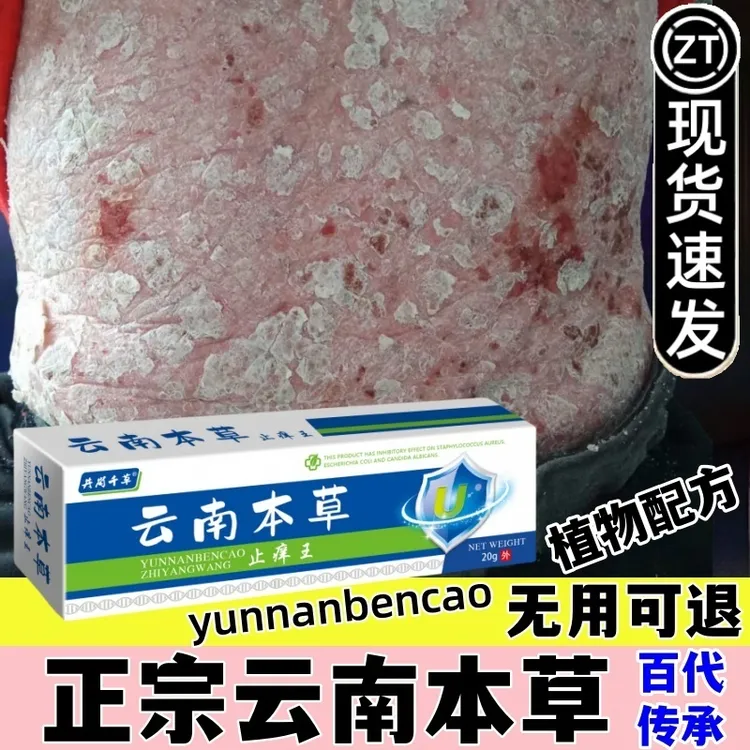 云南本草止痒王抑菌乳膏缓解皮肤瘙痒脚痒蚊虫咬痒屁屁痒涂抹清凉