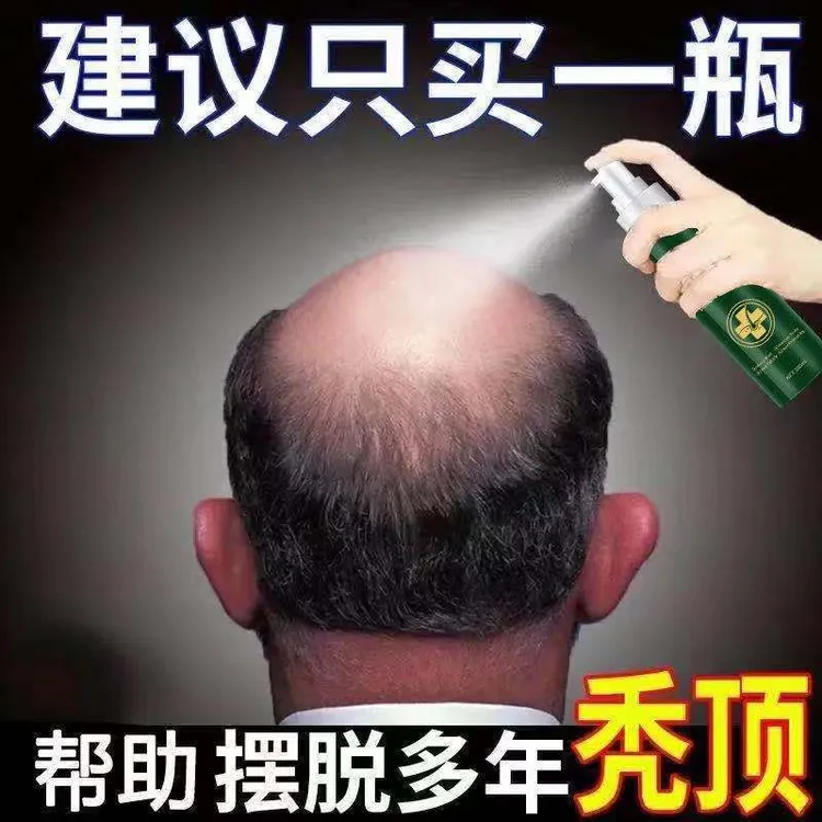 【日本技术】何首乌防护发育液男女掉头发温和养护头发稀疏喷雾